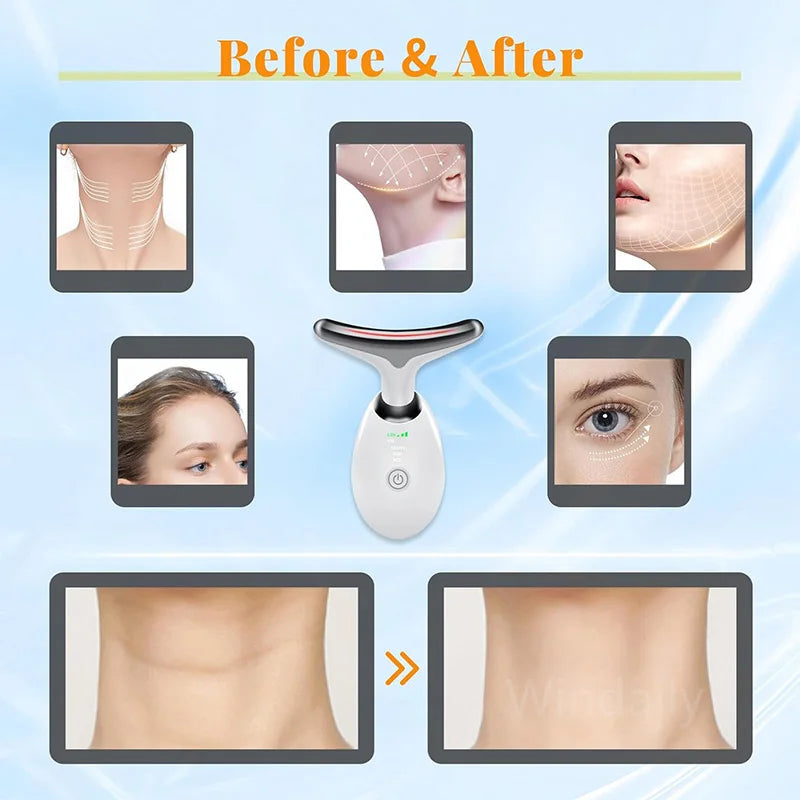 Radiance Lift Device-multi-function face and neck tool for smoother, firmer skin with warmth, vibration, light therapy.