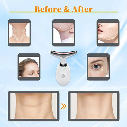 Radiance Lift Device-multi-function face and neck tool for smoother, firmer skin with warmth, vibration, light therapy.